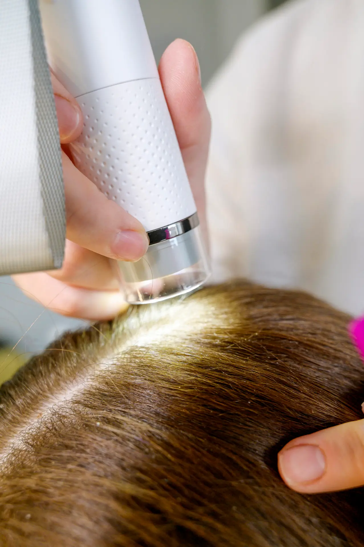 Kreisrunder Haarausfall im Salon: Was zwischen zwei Arztterminen wirklich hilft